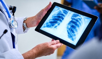 Chest X-Ray