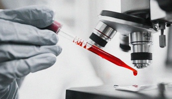 Complete Blood Count